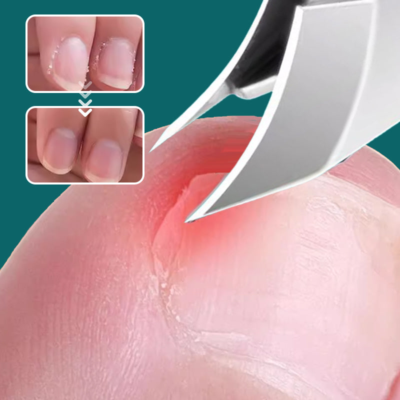 Anti-Splash Slant Edge Nail Clipper 3-Piece Set – Precise Cut | Safe Splash Guard