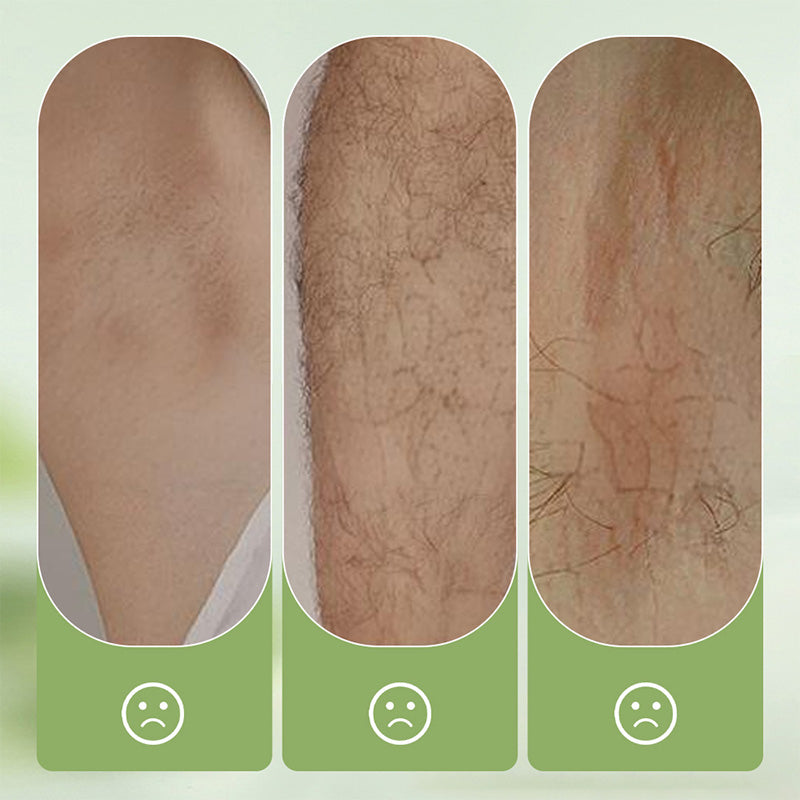 🧴 50% OFF NOW! 🪒 Gentle and Mild Set – Hair Removal Cream + Razor – Pain-Free for Sensitive Skin, No Dark Spots or Stubble 🌸